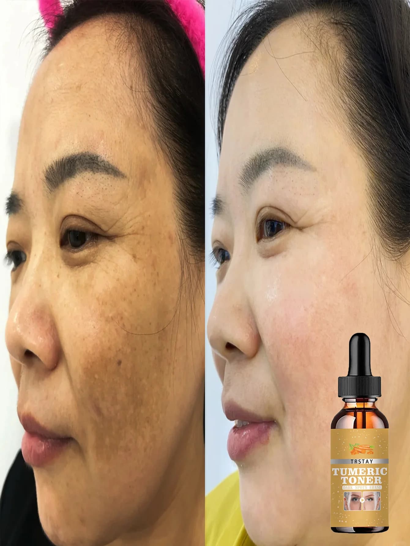 Hydrating Brightening Serum for Radiant Skin Fade Dark Spots Improve Dullness Lift Tighten Skin with Wrinkle Resistant Essence a