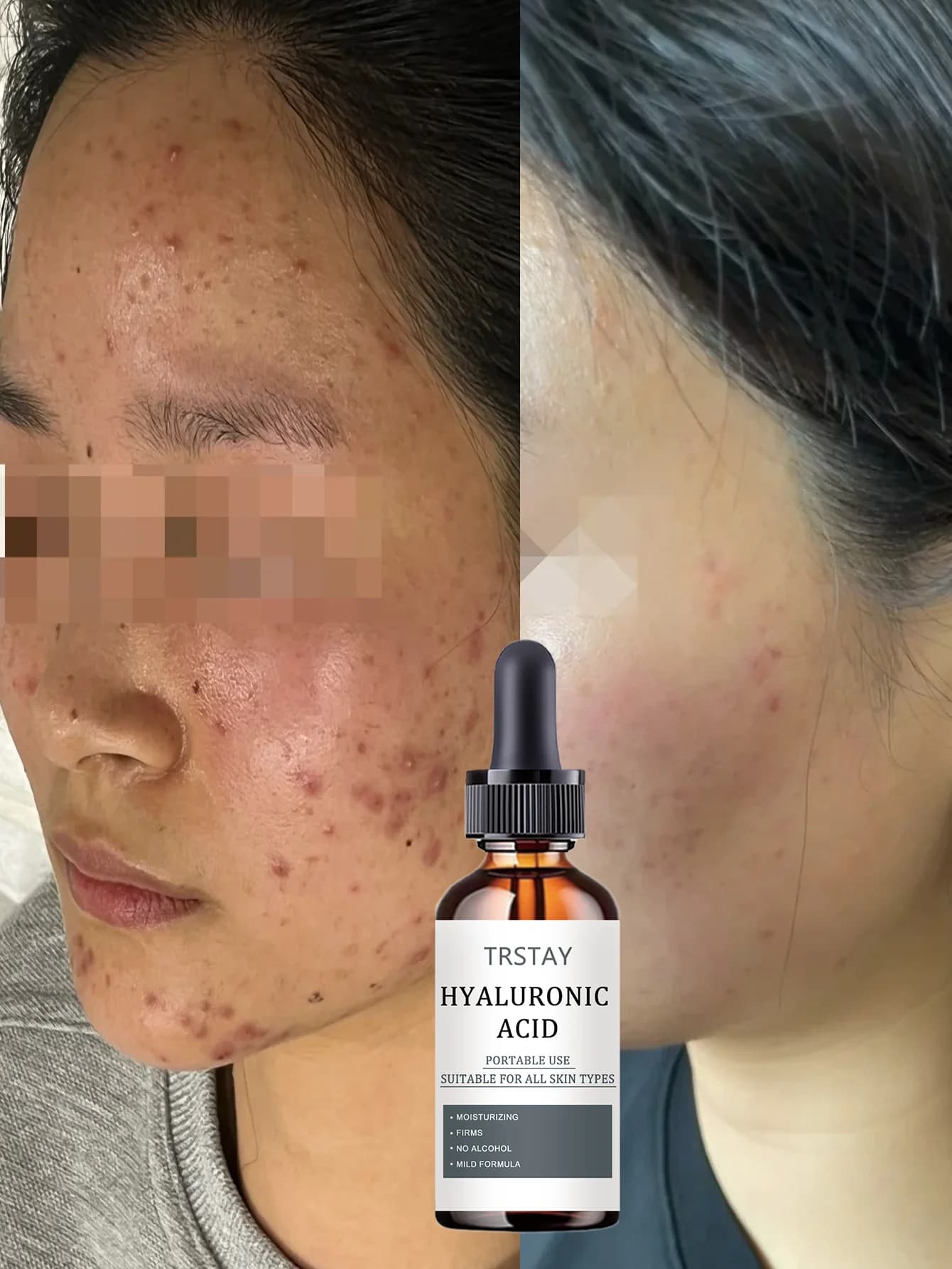 Hydrating Lift Anti Wrinkle Essence for All Skin Types Deeply Nourishes and Revitalizes Skin for Radiant Glow and Smooth Texture