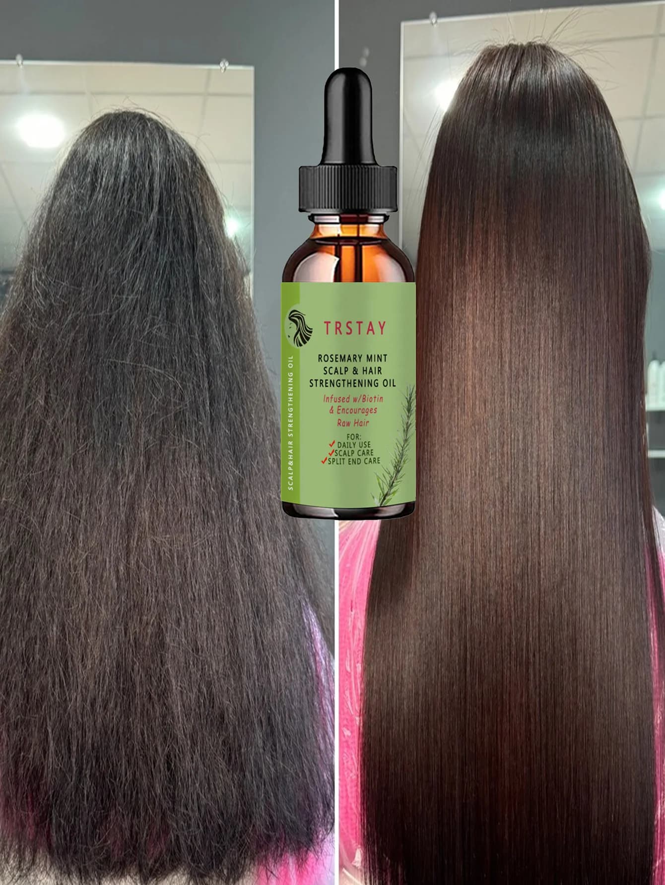 Staying Up Late Without Losing Hair Anti Shedding Essential Oil Improves Blood Circulation Nourishes Thick Hair For Strong Healt