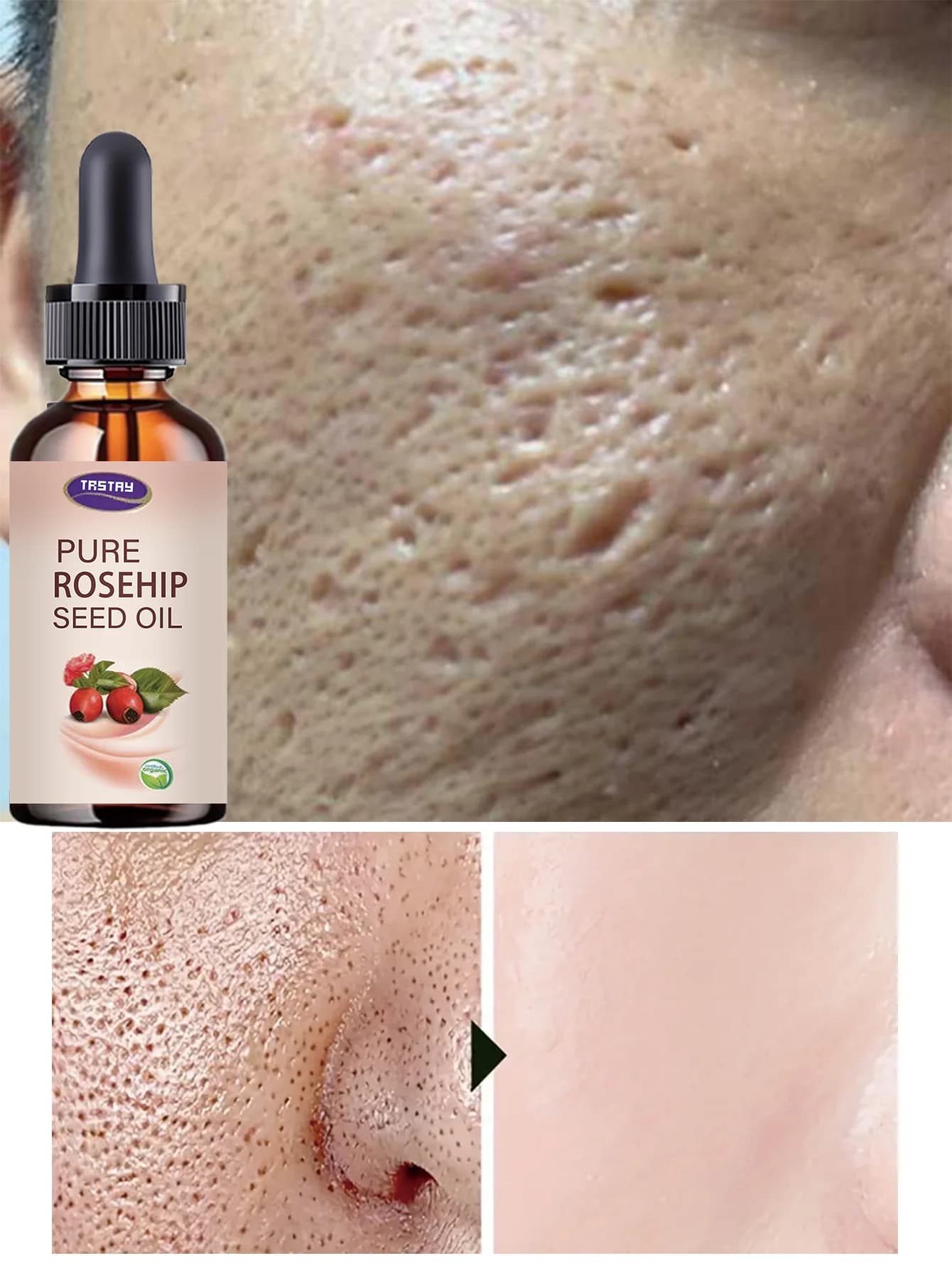 Advanced Hydrating Serum with Vitamin E for Deep Moisture Lock and Skin Barrier Repair Promotes Youthful Glow Suitable for All S