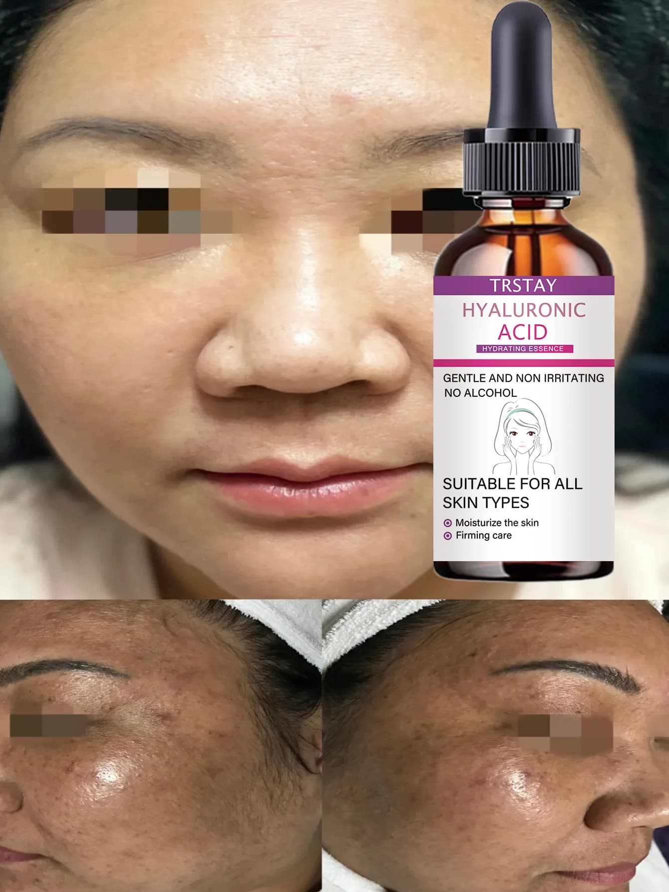 Moisturizing Anti Wrinkle Spot Lightening Essence Deeply Hydrates Nourishes Repairs Revitalizes Skin For Flawless Firm Smooth Co