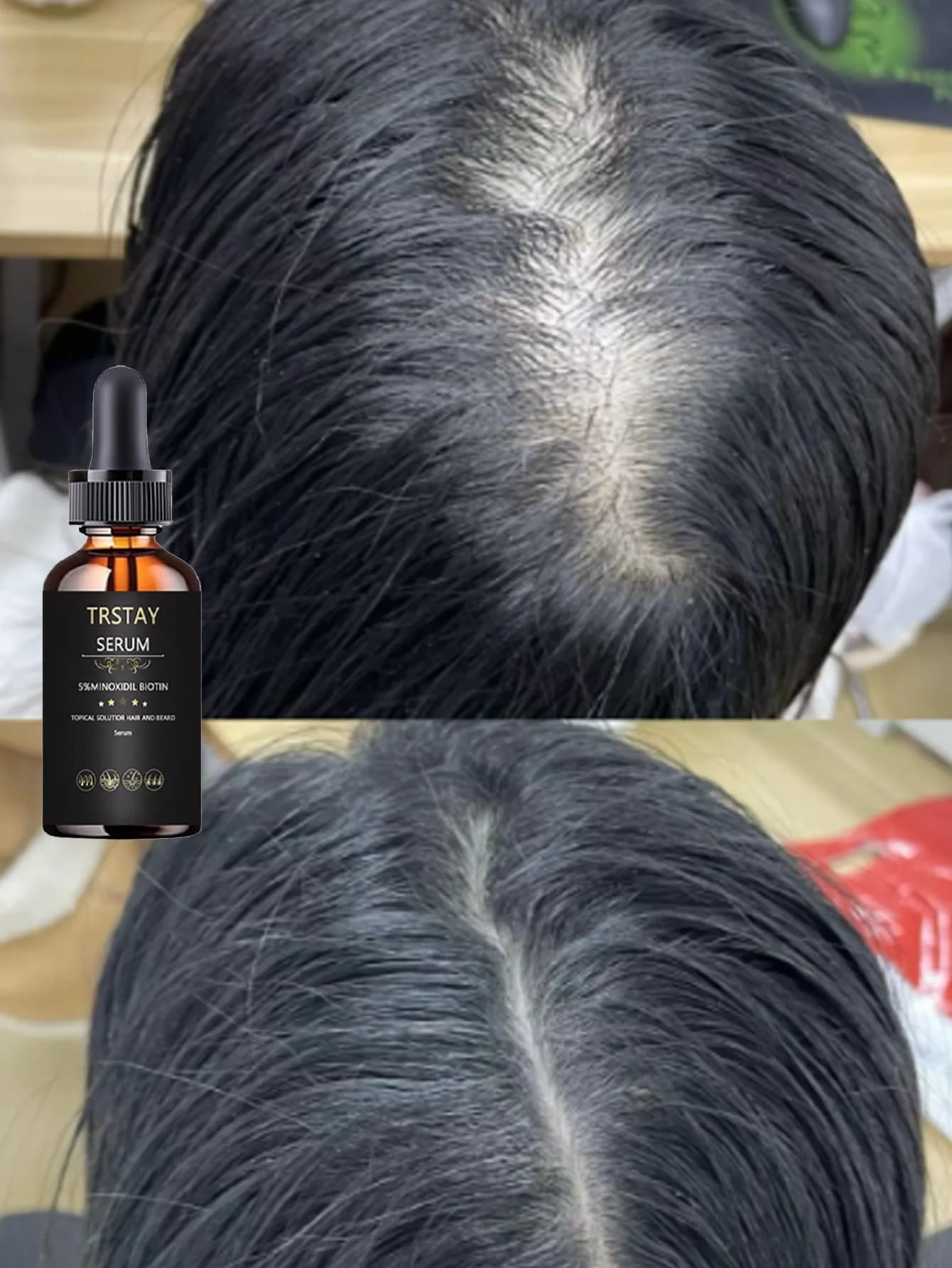 Moisturizing Essential Oil Strengthen Hair Improve Hair Elasticity Hydrate Fine Hair Look Thicker Natural Hair Care Solution For