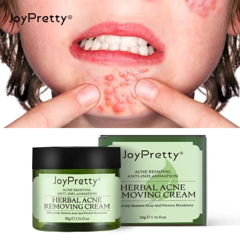 JoyPretty 허브 여드름 제거 크림 진정 보습